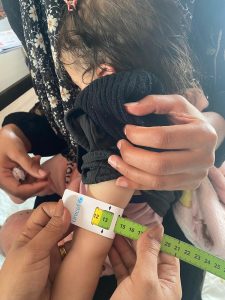 استجابة طارئة للحد من سوء التغذية بالشراكة مع (SOS) فلسطين وتمويل من (DRA)